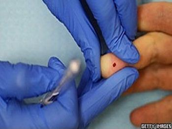 Cientistas de Londres criam exame barato para detecção de Câncer, HIV e outras doenças