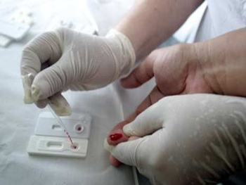 Teste de HIV em criança de risco deve ser feito o mais rápido possível