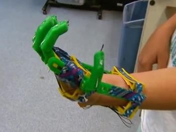 Menina com deficiência recebe prótese de mão feita com impressora 3D